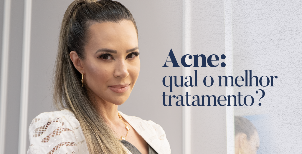 acne: qual o melhor tratamento